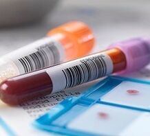 Diagnoza laboratoryjna zapalenia prostaty
