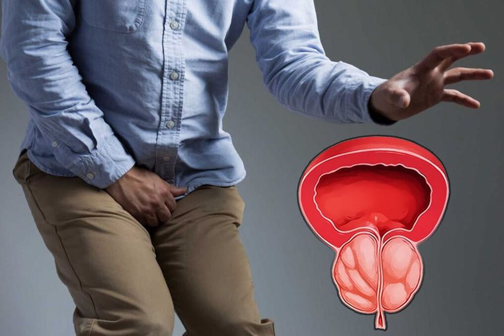 ostra prostata u mężczyzn